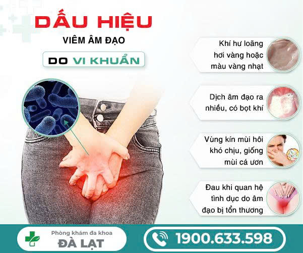 Hình ảnh minh họa